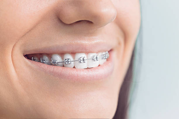 Best Teeth Whitening  in Wilmington, OH
